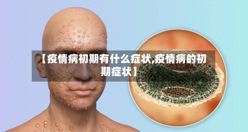 【疫情病初期有什么症状,疫情病的初期症状】-第1张图片