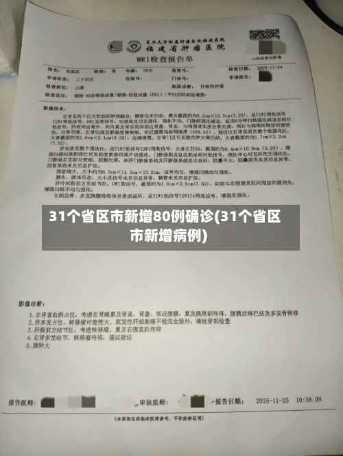 31个省区市新增80例确诊(31个省区市新增病例)-第2张图片