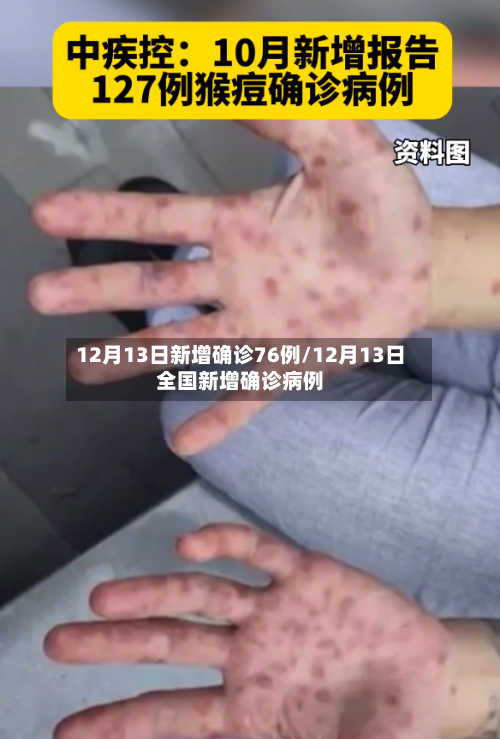 12月13日新增确诊76例/12月13日全国新增确诊病例-第1张图片