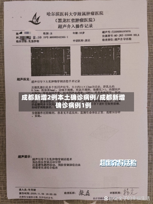 成都新增2例本土确诊病例/成都新增确诊病例1例-第2张图片