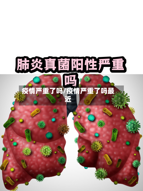 疫情严重了吗/疫情严重了吗最近-第2张图片